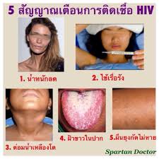 liv-capsule-hiv-aids